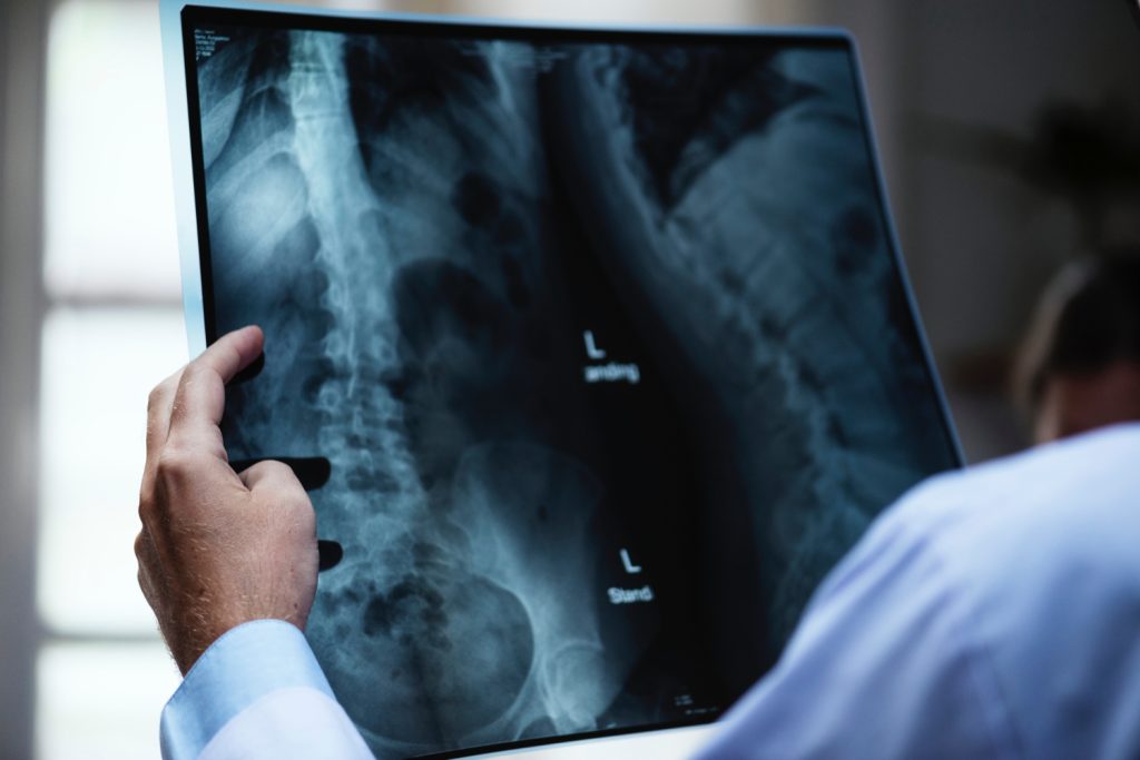 How Precision Imaging Is Transforming Early-Stage Research Strategies | StrategyDriven Tactical Execution Article